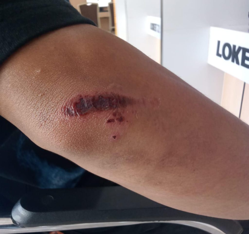 Aksi Begal Bersajam Kembali Terjadi, Warga Makassar Jadi Korban di Jalan Tinumbu