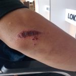 Aksi Begal Bersajam Kembali Terjadi, Warga Makassar Jadi Korban di Jalan Tinumbu