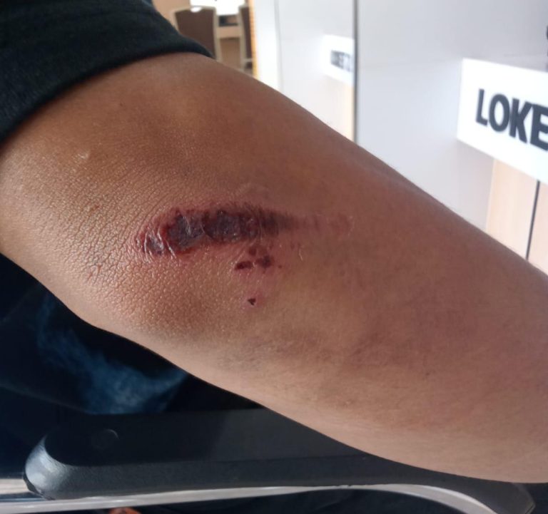 Aksi Begal Bersajam Kembali Terjadi, Warga Makassar Jadi Korban di Jalan Tinumbu